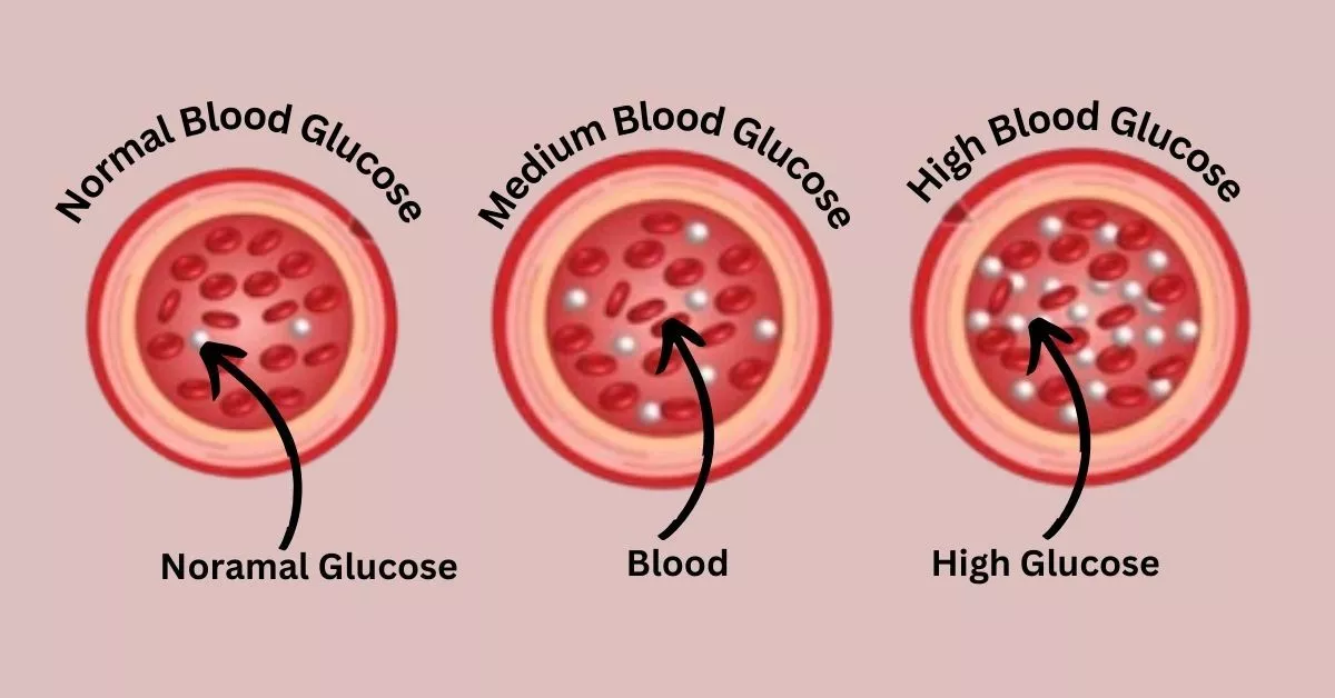 What is Diabetes