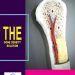 The Bone Density Solution