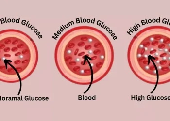 What is Diabetes