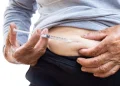 Insulin Injection Sites