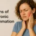 Natural Remedies for Inflammation